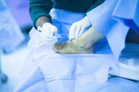 injecting a injured foot
