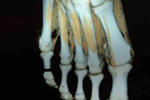 hand x-ray image
