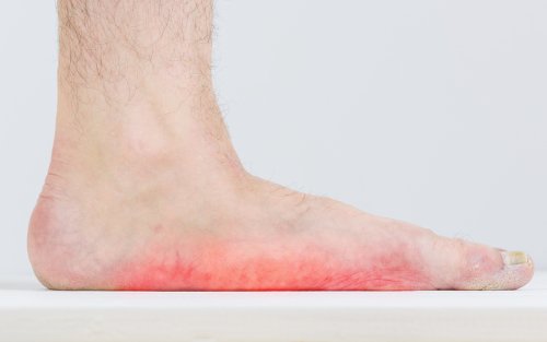 redness under foot