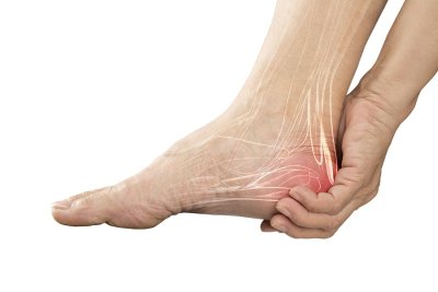 Tarsal Tunnel Syndrome