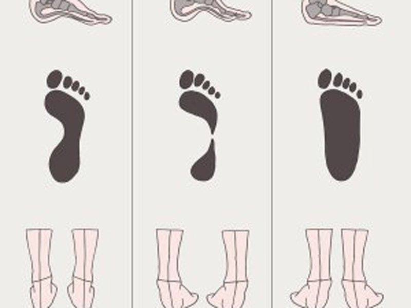 Image of a foot patterns