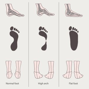 Image of a foot patterns