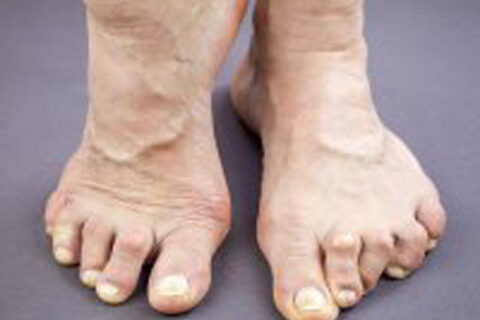 Image of a feets
