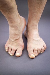 Image of a feets