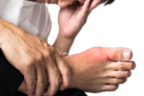 injured feet of a man
