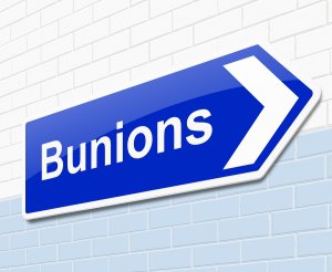Bunions inside the arrow image