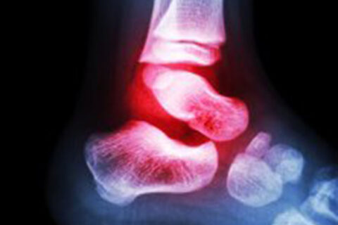 x-ray image of leg