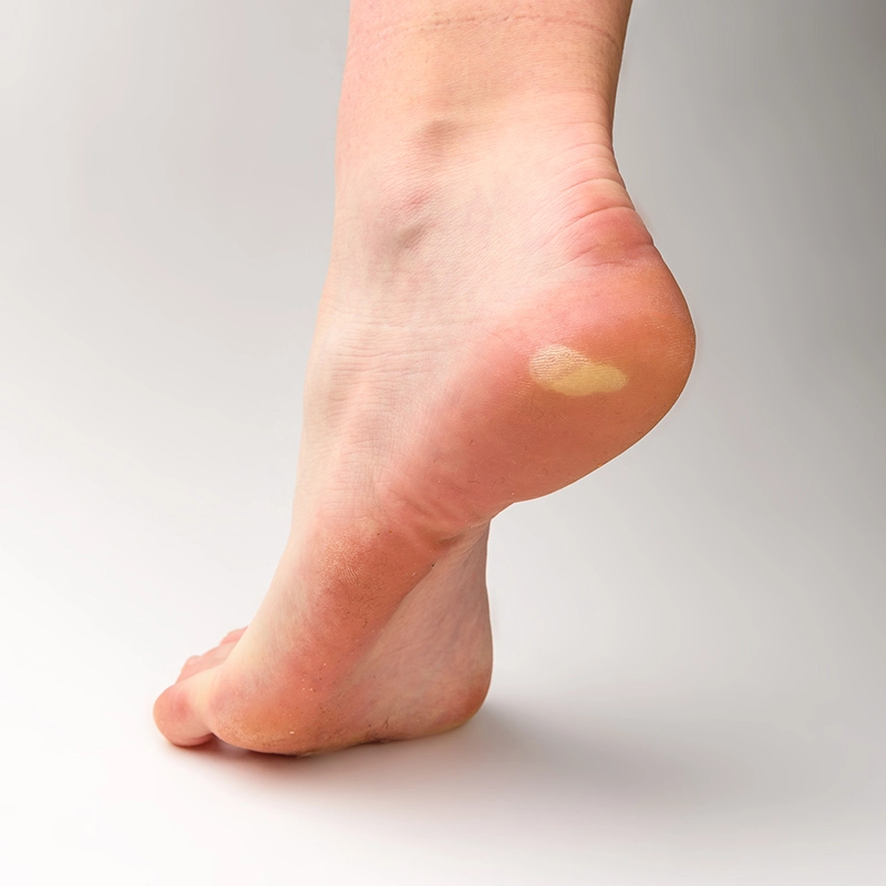 A Thorough Foot Examination