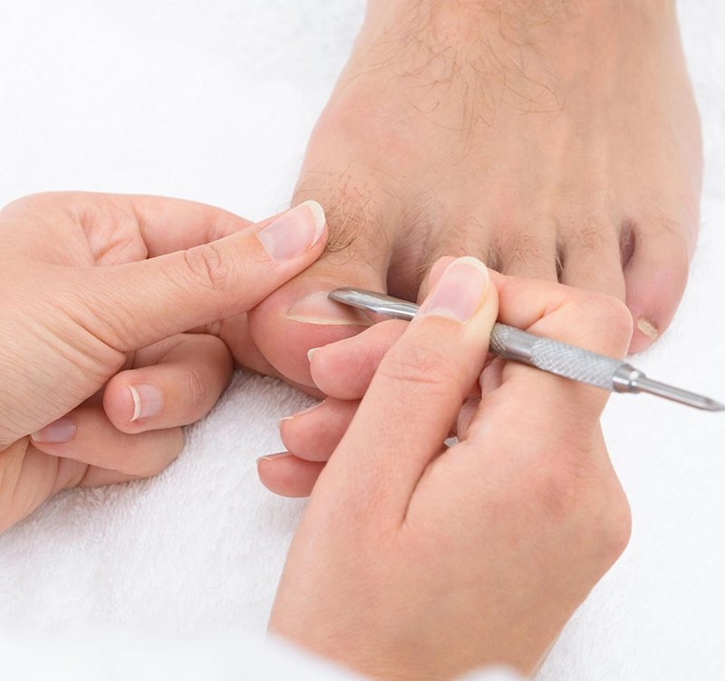 Nail Problems Prevention